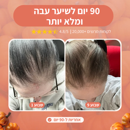 שמן זרעי דלעת - קפסולות רכות